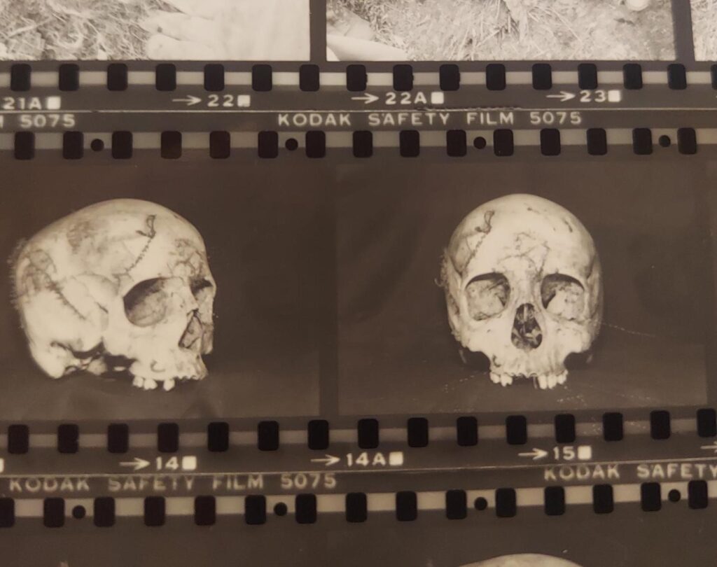 Police photo of a human skull.